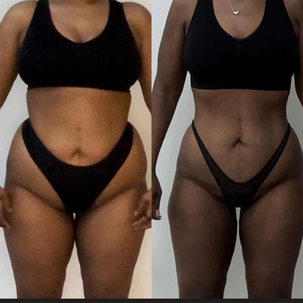 Transformation 3